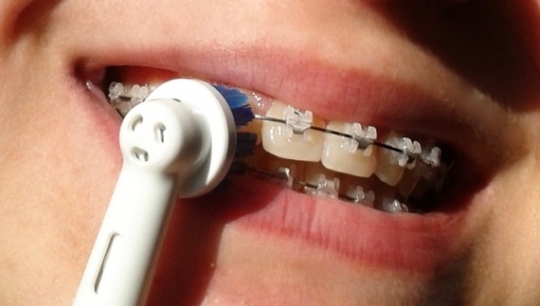 Utilisation d'une brosse électrique sur appareil dentaire