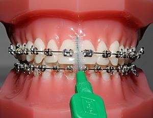 Utilisation de la brossette interdentaire